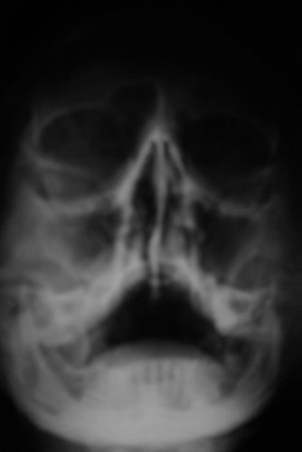 Carlos Moyano Ceniza-6